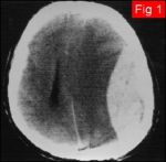u1111t03.jpg